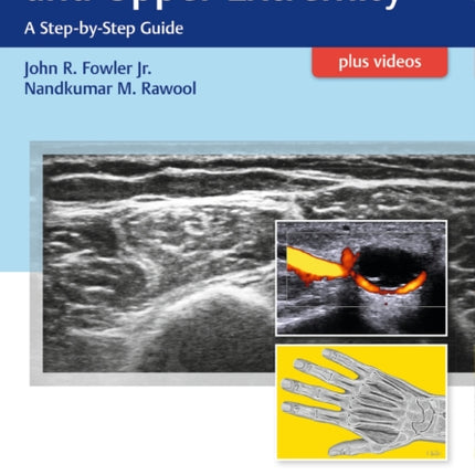 Ultrasound of the Hand and Upper Extremity