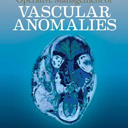 Operative Management of Vascular Anomalies