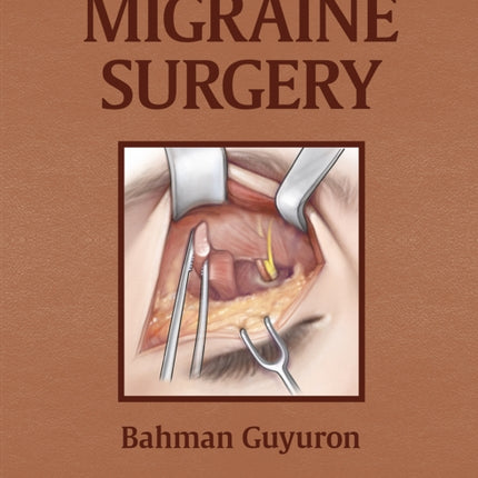 Migraine Surgery