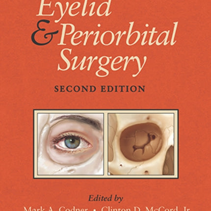 Eyelid and Periorbital Surgery