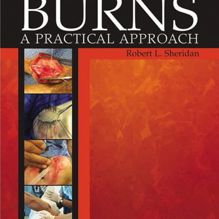 Burns: A Practical Approach to Immediate Treatment and Long-Term Care