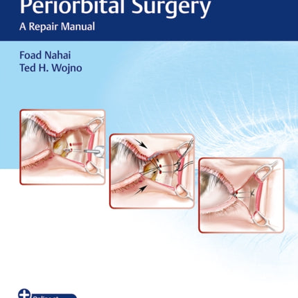 Problems in Periorbital Surgery