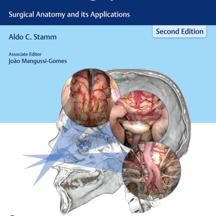 Transnasal Endoscopic Skull Base and Brain Surgery