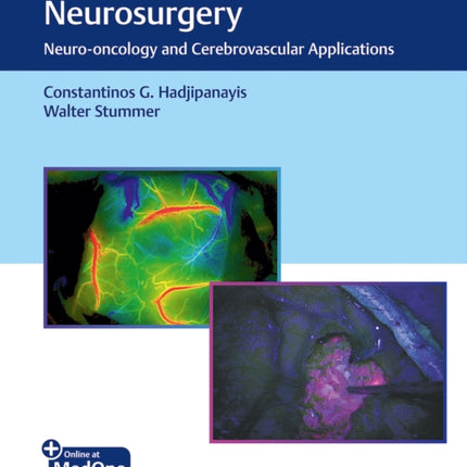 FluorescenceGuided Neurosurgery