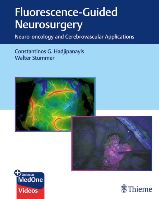 FluorescenceGuided Neurosurgery