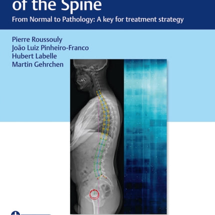 Sagittal Balance of the Spine