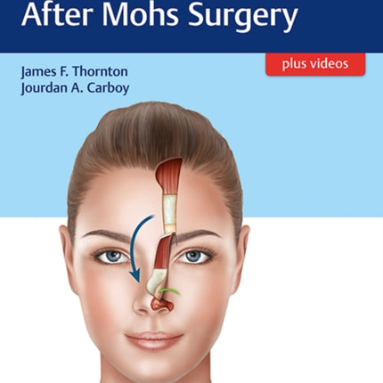 Facial Reconstruction After Mohs Surgery
