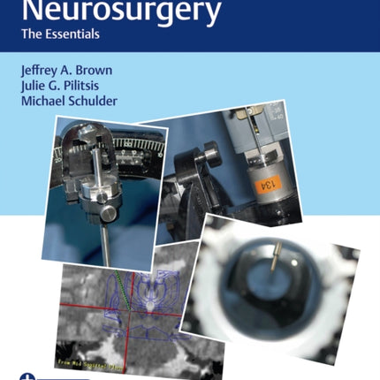 Functional Neurosurgery: The Essentials