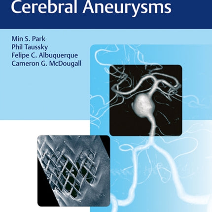 Flow Diversion of Cerebral Aneurysms