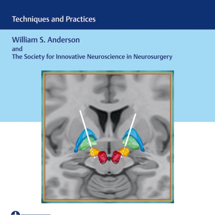 Deep Brain Stimulation: Techniques and Practices