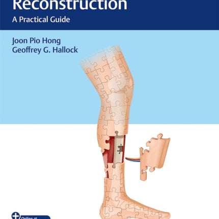 Lower Extremity Reconstruction