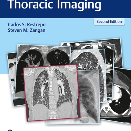 RadCases Plus Q&A Thoracic Imaging