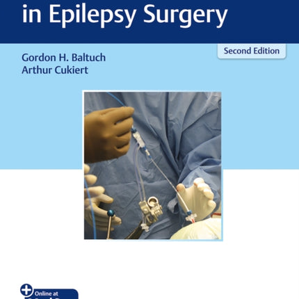 Operative Techniques in Epilepsy Surgery