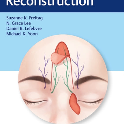 Eyelid Reconstruction