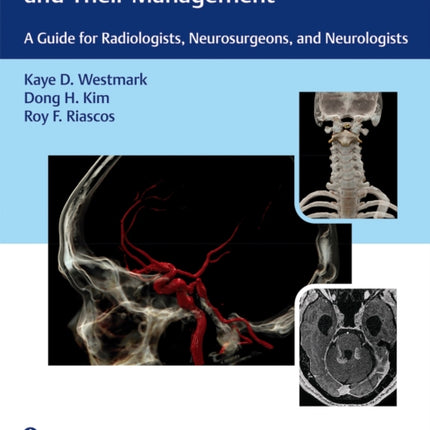 Incidental Findings in Neuroimaging and Their Management