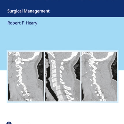 Cervical Trauma