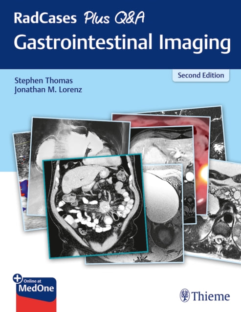 RadCases Plus Q&A Gastrointestinal Imaging