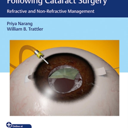 Optimizing Suboptimal Results Following Cataract Surgery