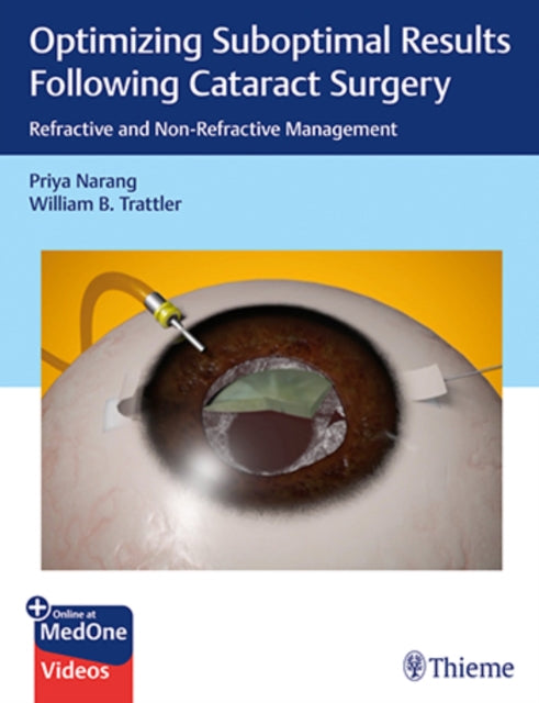 Optimizing Suboptimal Results Following Cataract Surgery