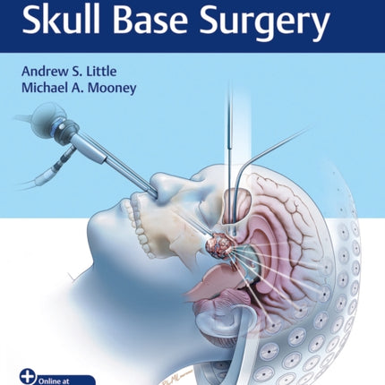 Controversies in Skull Base Surgery