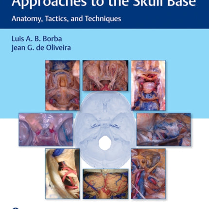 Microsurgical and Endoscopic Approaches to the Skull Base