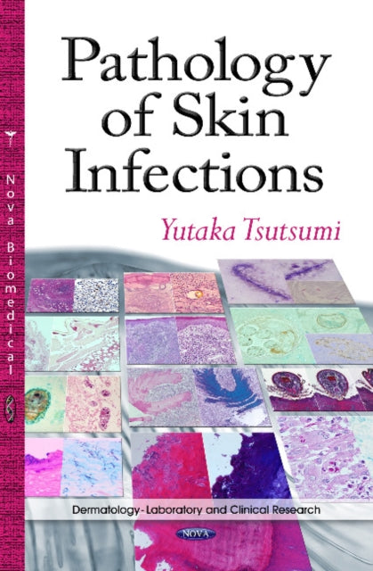 Pathology of Skin Infections