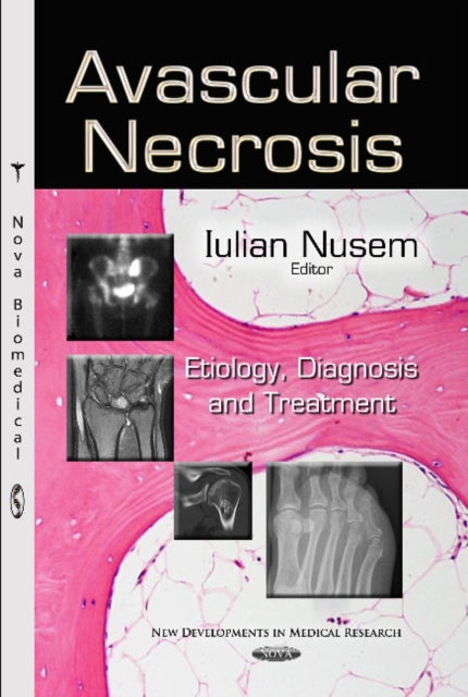 Avascular Necrosis: Etiology, Diagnosis & Treatment