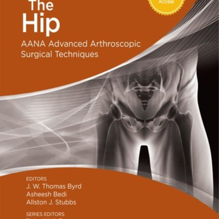 The Hip: AANA Advanced Arthroscopic Surgical Techniques