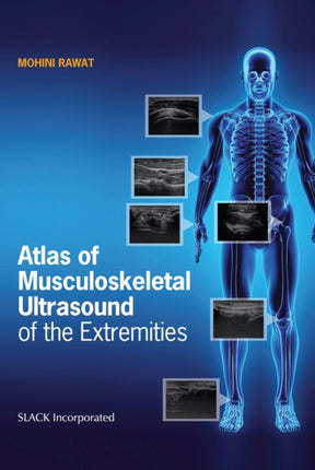 Atlas of Musculoskeletal Ultrasound of the