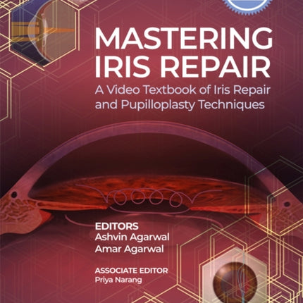 Mastering Iris Repair: A Video Textbook of Iris Repair and Pupilloplasty Techniques