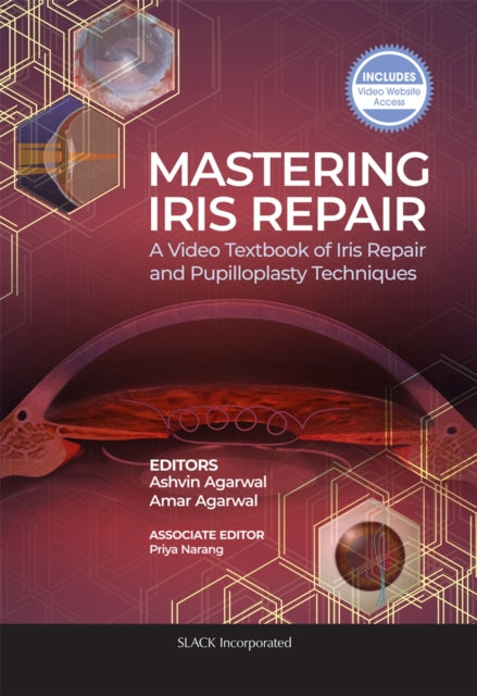 Mastering Iris Repair: A Video Textbook of Iris Repair and Pupilloplasty Techniques