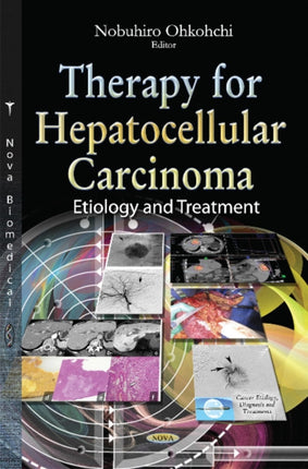 Therapy for Hepatocellular Carcinoma: Etiology &