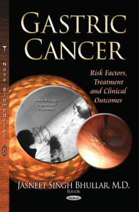 Gastric Cancer: Risk Factors, Treatment & Clinical Outcomes