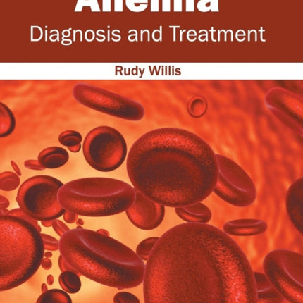 Anemia: Diagnosis and Treatment