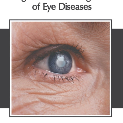Diagnosis and Management of Eye Diseases