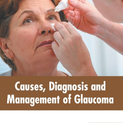 Causes, Diagnosis and Management of Glaucoma