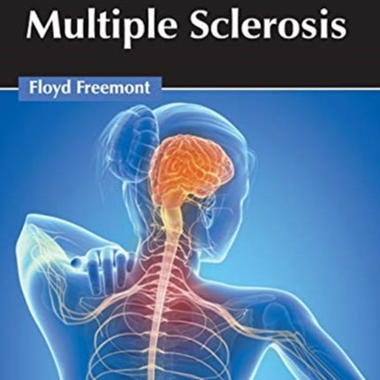 Handbook of Multiple Sclerosis