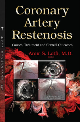 Coronary Artery Restenosis: Causes, Treatment and