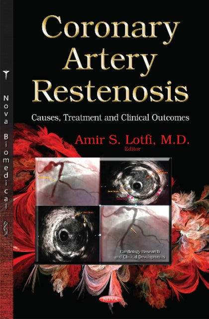 Coronary Artery Restenosis: Causes, Treatment and