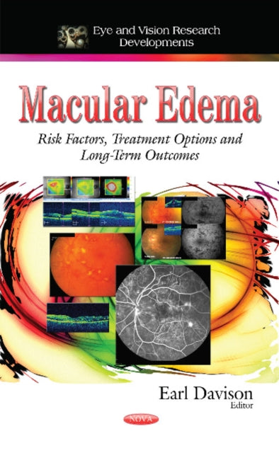 Macular Edema: Risk Factors, Treatment Options