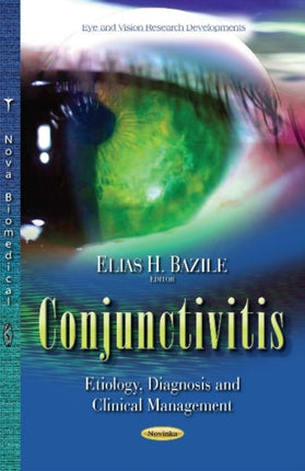 Conjunctivitis: Etiology, Diagnosis & Clinical