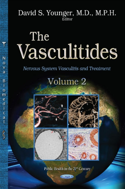 Vasculitidies: Volume 2 -- Nervous System Vasculitis & Treatment