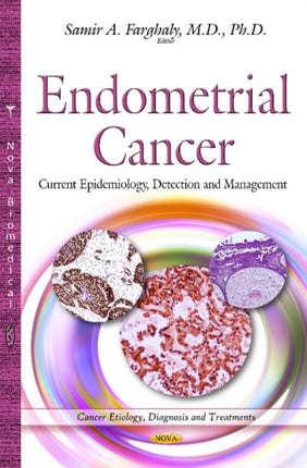 Endometrial Cancer: Current Epidemiology,