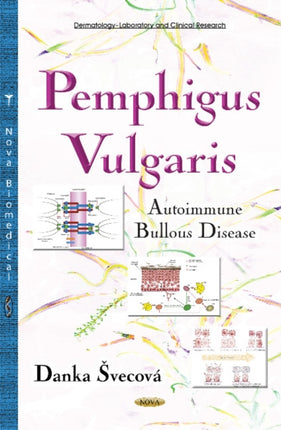 Pemphigus Vulgaris: Autoimmune Bullous Disease