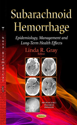 Subarachnoid Hemorrhage: Epidemiology, Management