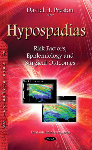 Hypospadias: Risk Factors, Epidemiology &
