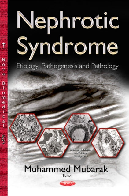 Nephrotic Syndrome: Etiology, Pathogenesis &