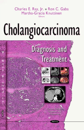 Cholangiocarcinoma: Diagnosis & Treatment