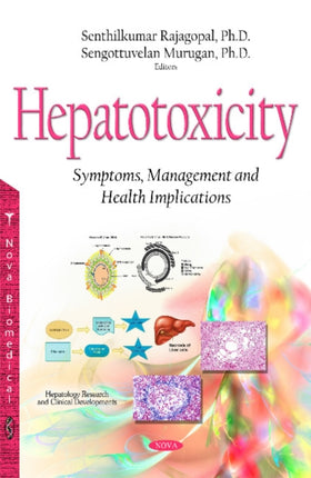 Hepatotoxicity: Symptoms, Management & Health