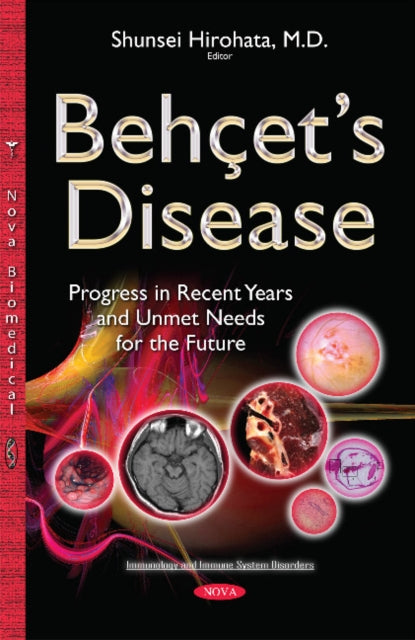 Behçets Disease: Progress in Recent Years & Unmet